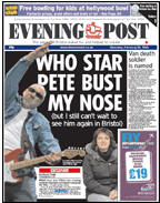 Who Star Pete Bust My Nose